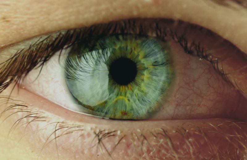 Das Bild zeigt ein Auge.