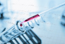 The image shows test tubes and a pipette in a laboratory.